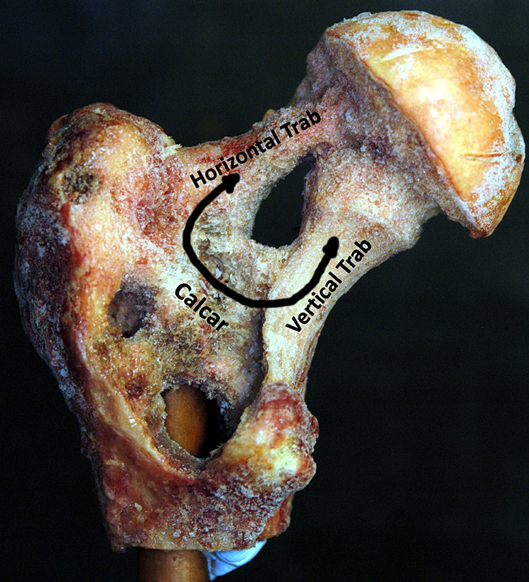 大腿骨骨梁に関する基礎知識